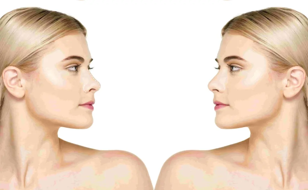 rahasia-wajah-tirus-di-lavalen-cara-efektif-membentuk-v-shape-face