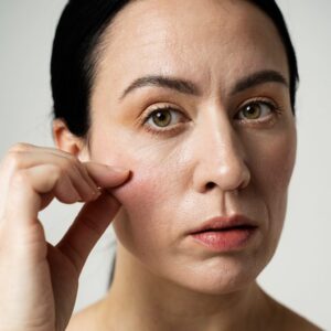 1.Pasien-yang-sudah-mulai-memperlihatkan-tanda-penuaan-seperti-kulit-kendur-kusam-munculnya-garis-garis-halus-dan-kerutan-serta-mengalami-kulit-kering-1536x1536