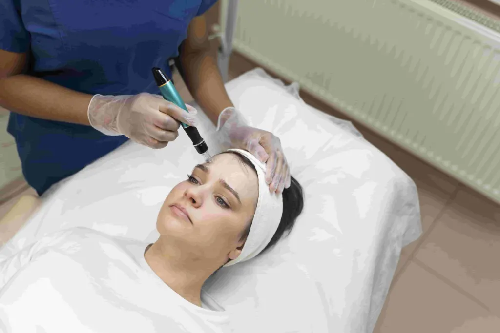 perawatan-microneedling-terbaik-di-jakarta
