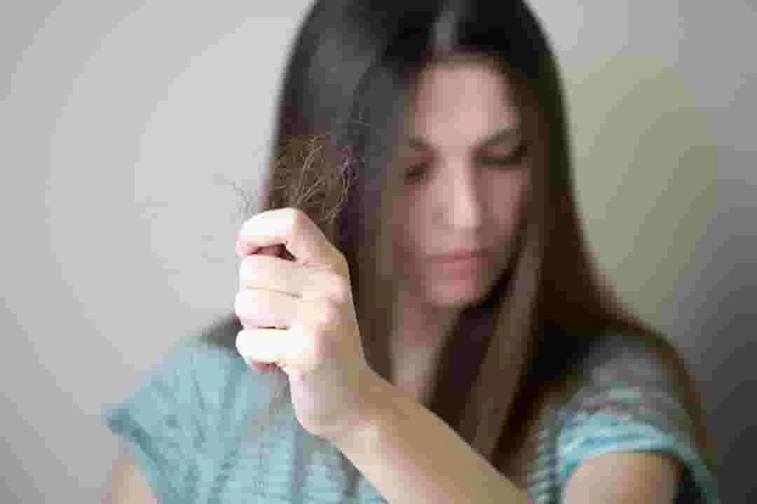 perawatan-rambut-kering-dan-ketombe-di-lavalen