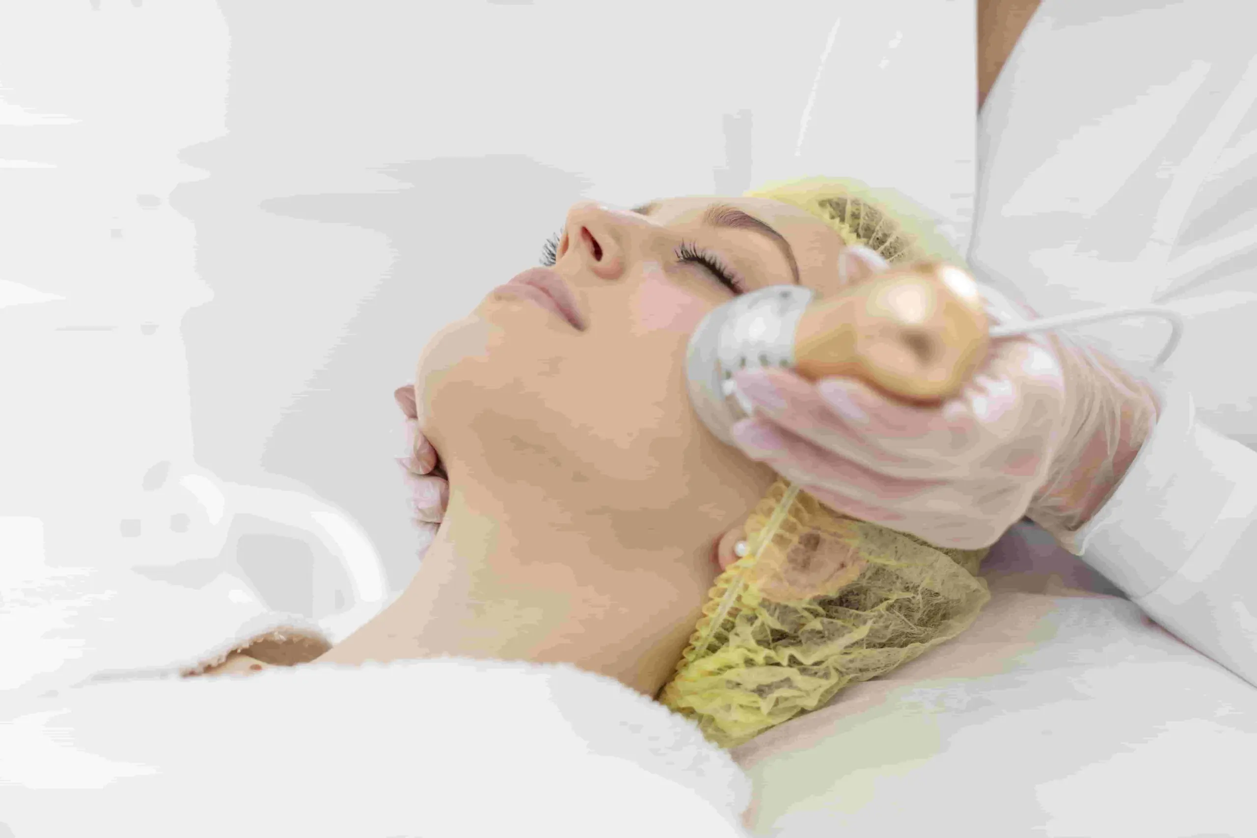 treatment-laser-resurfacing-di-lavalen