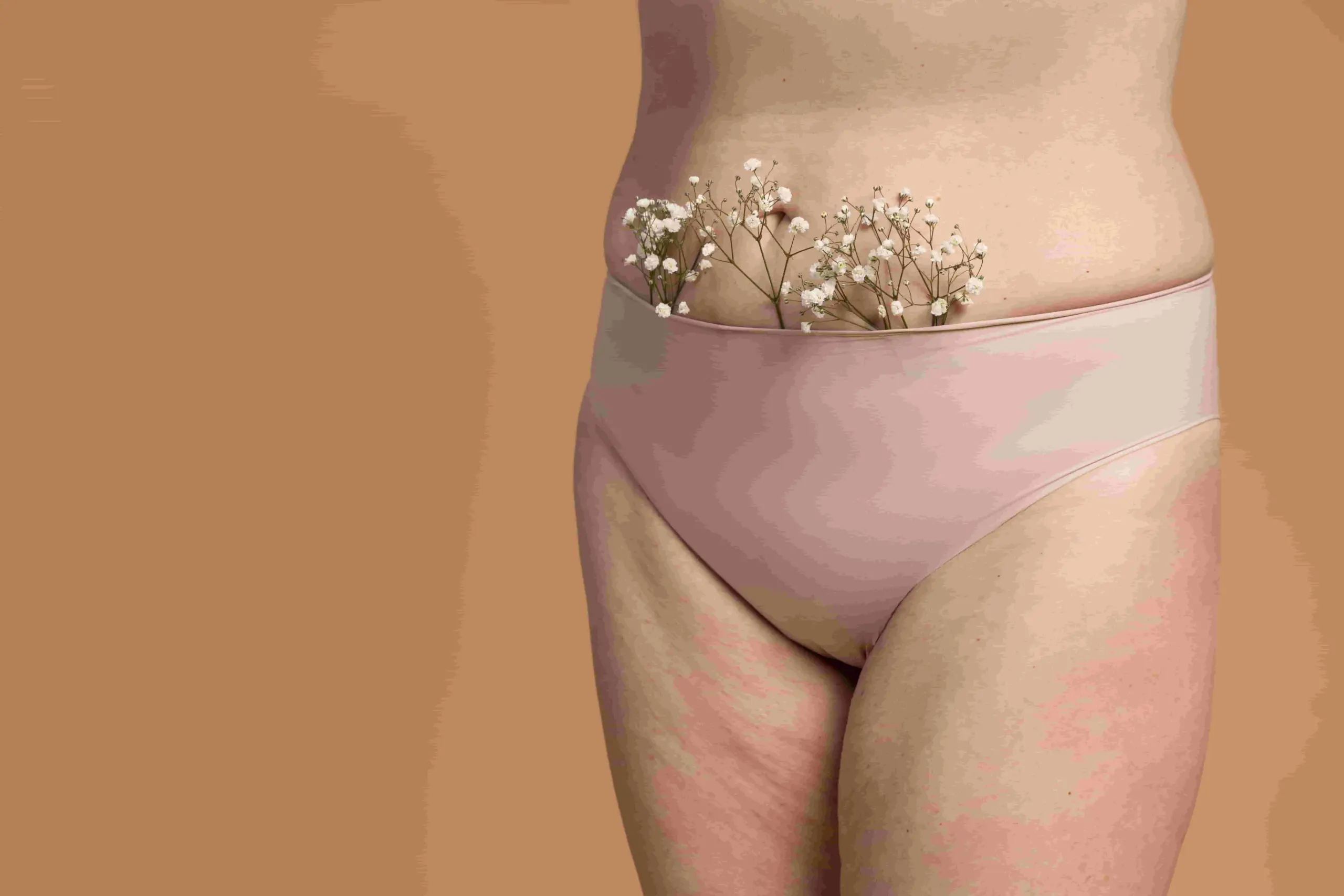perawatan-selulit-dan-stretch-mark-di-jakarta