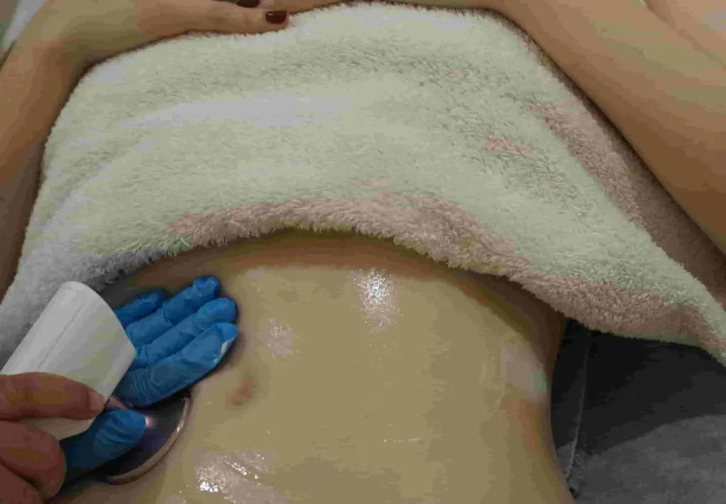 treatment-cold-lift-terbaik-di-lavalen