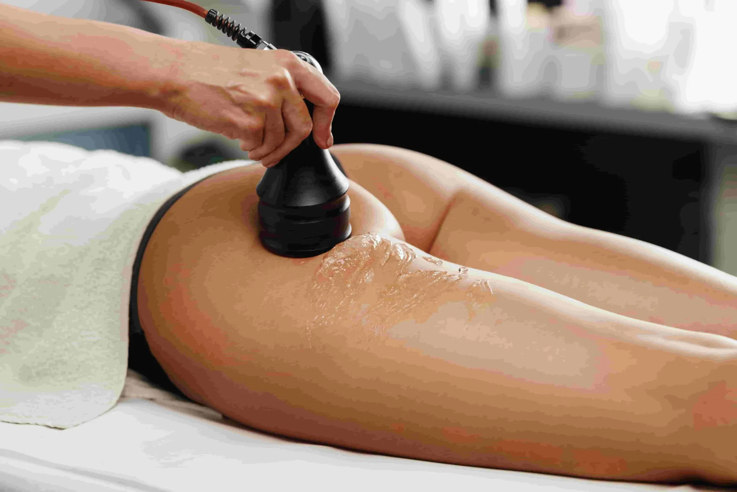 treatment-venus-cellulite