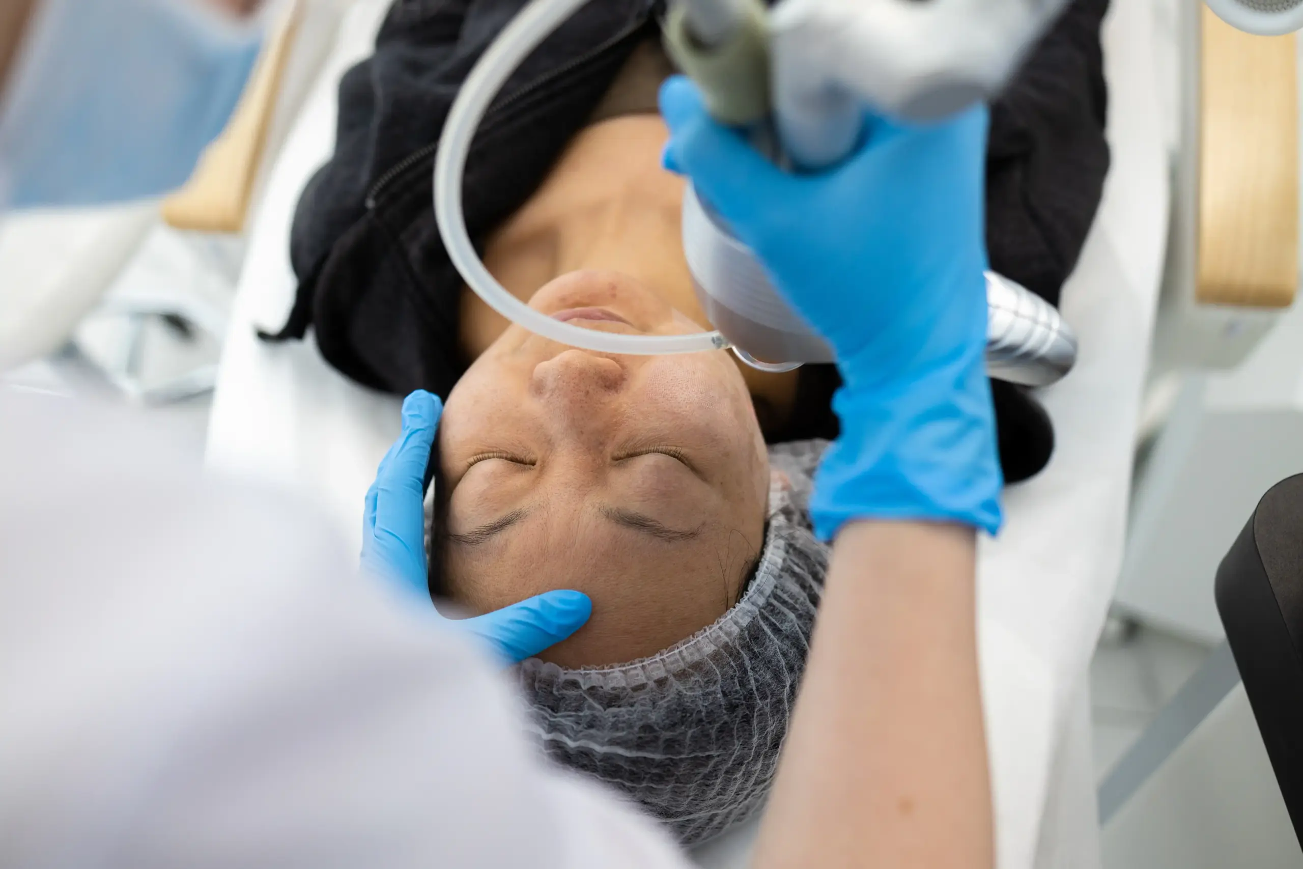 Seorang wanita sedang menjalani treatment HIFU di klinik kecantikan untuk mengencangkan kulit wajah tanpa operasi.