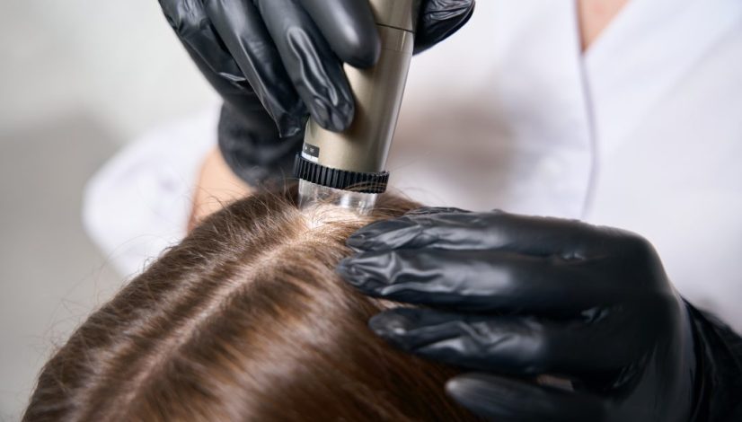 Rekomendasi Scalp Detox