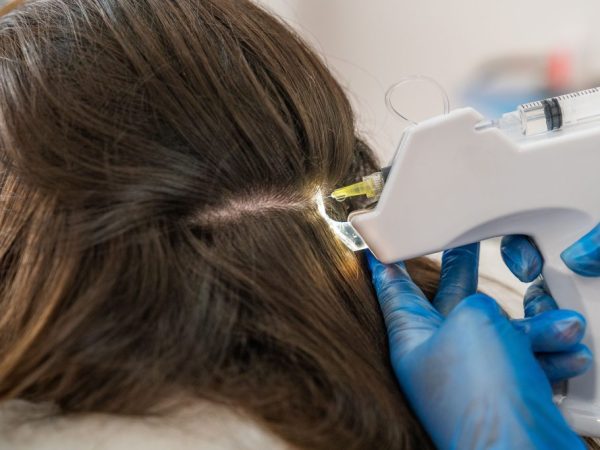 Rekomendasi Scalp Detox Lavalen Beauty