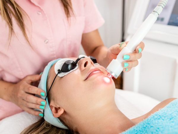 microneedling wajah lavalen beauty