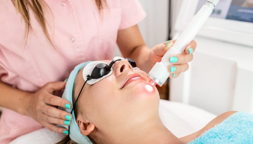 microneedling wajah lavalen beauty