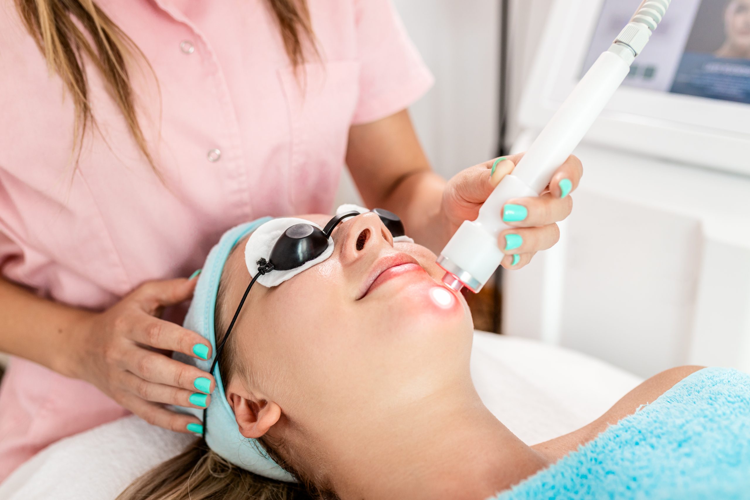 microneedling wajah lavalen beauty