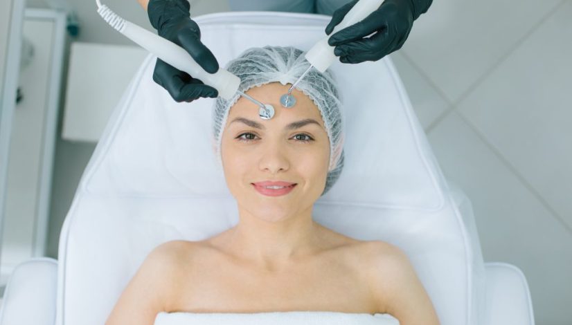 laser flek hitam lavalen beauty