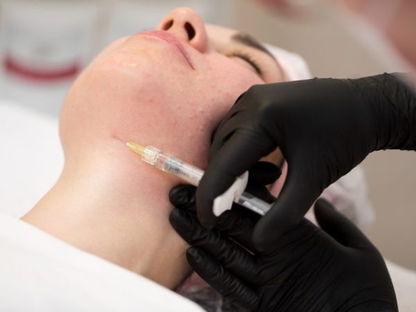 skin booster wajah lavalen beauty