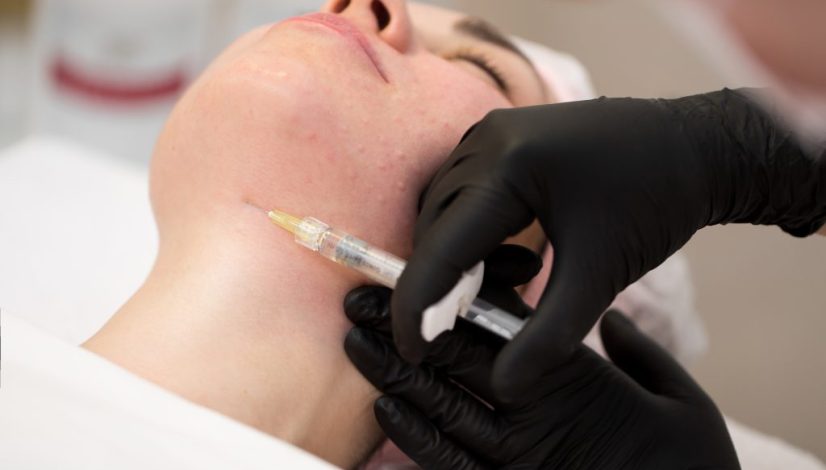 skin booster wajah lavalen beauty