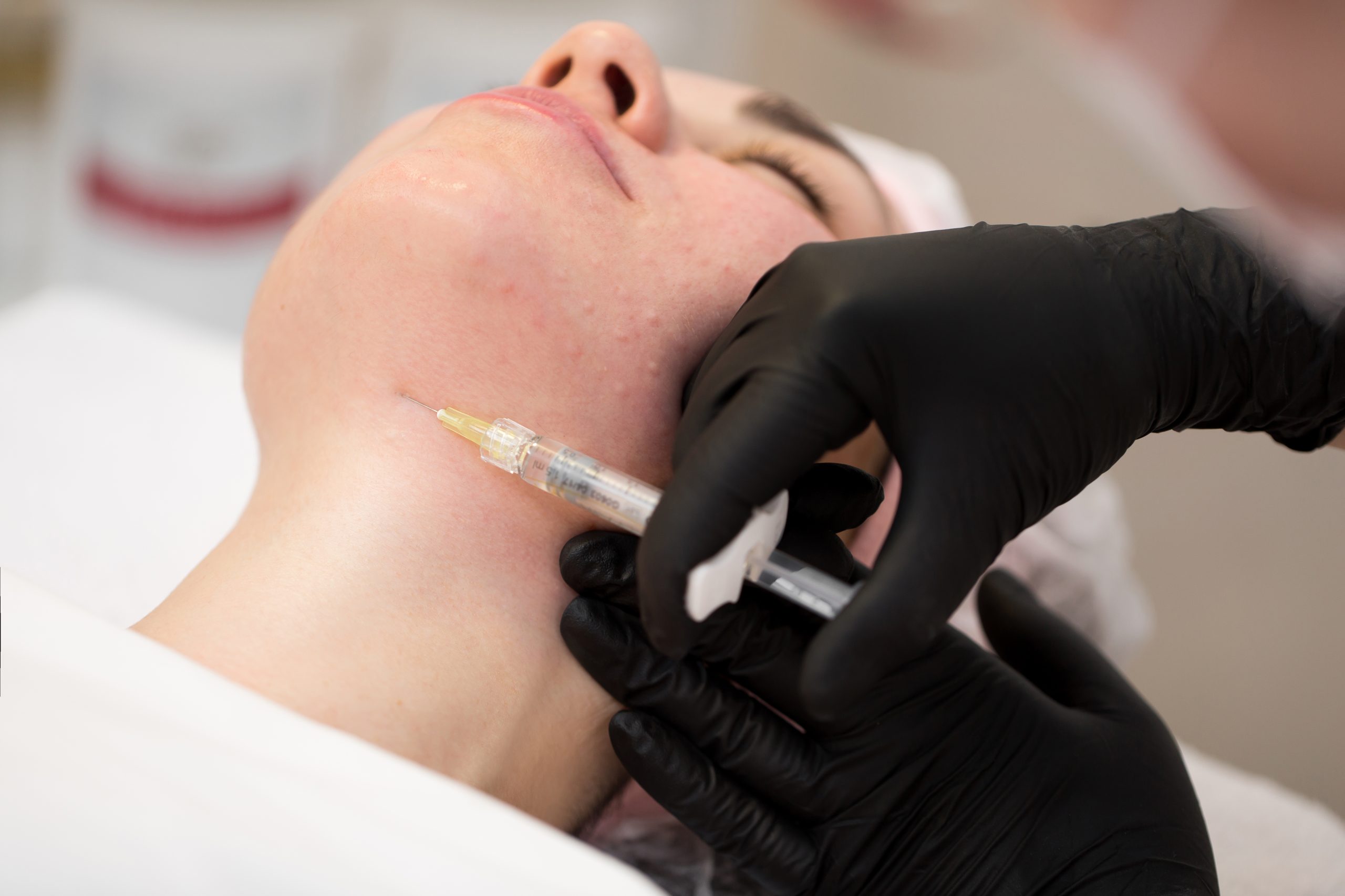 skin booster wajah lavalen beauty