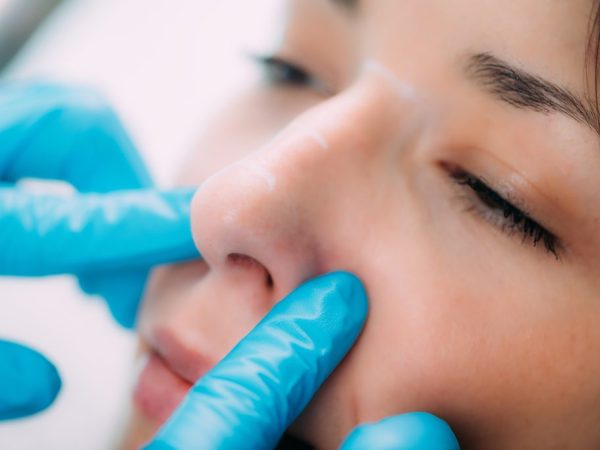 seorang wanita sedang filler hidung