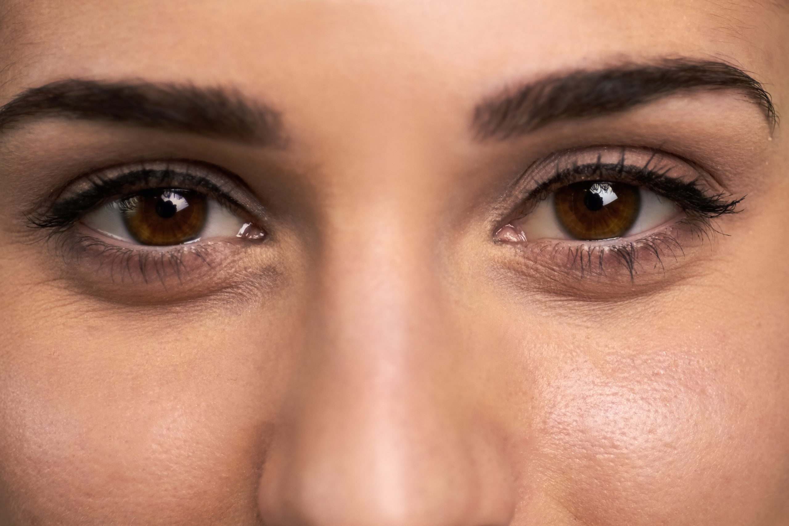 cara menghilangkan mata panda di klinik kecantikan lavalen beauty