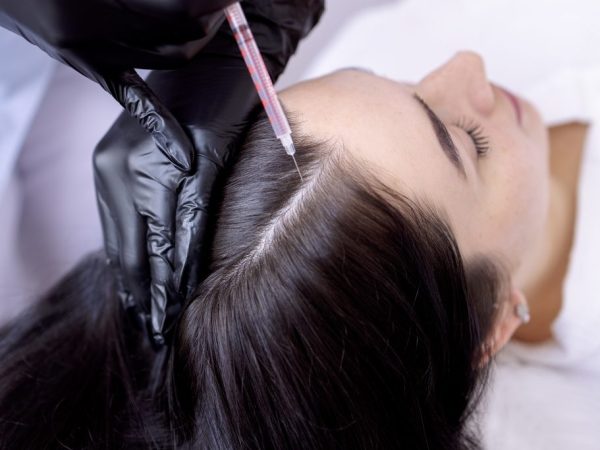 perawatan rambut rontok lavalen beauty