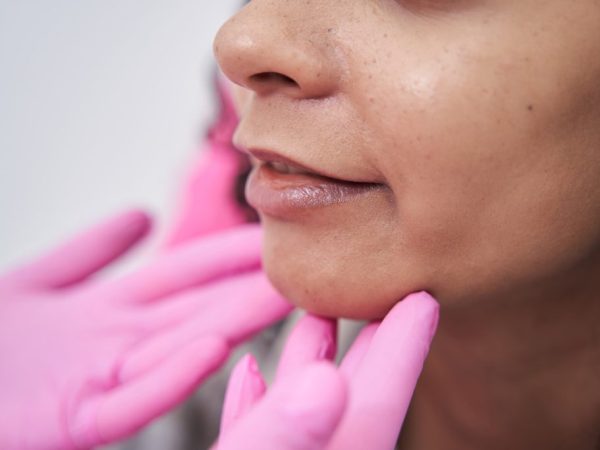 menghilangkan double chin lavalen beauty