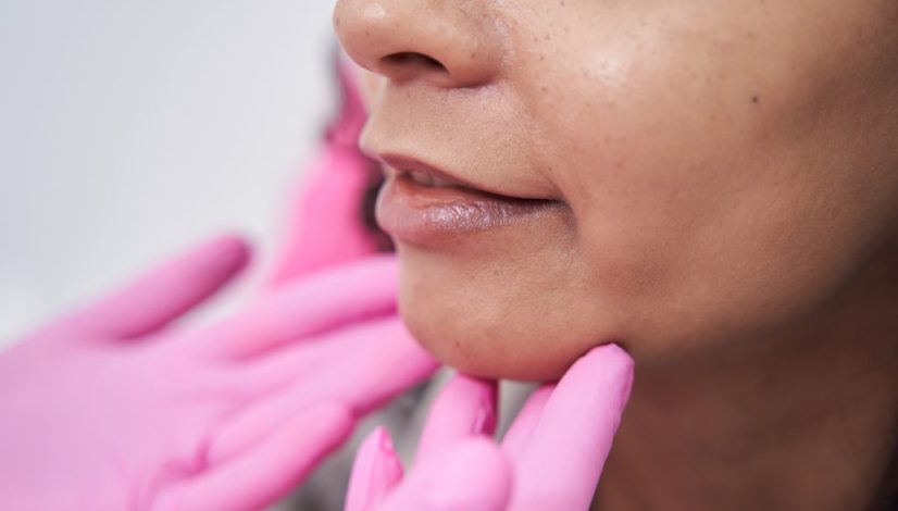 menghilangkan double chin lavalen beauty