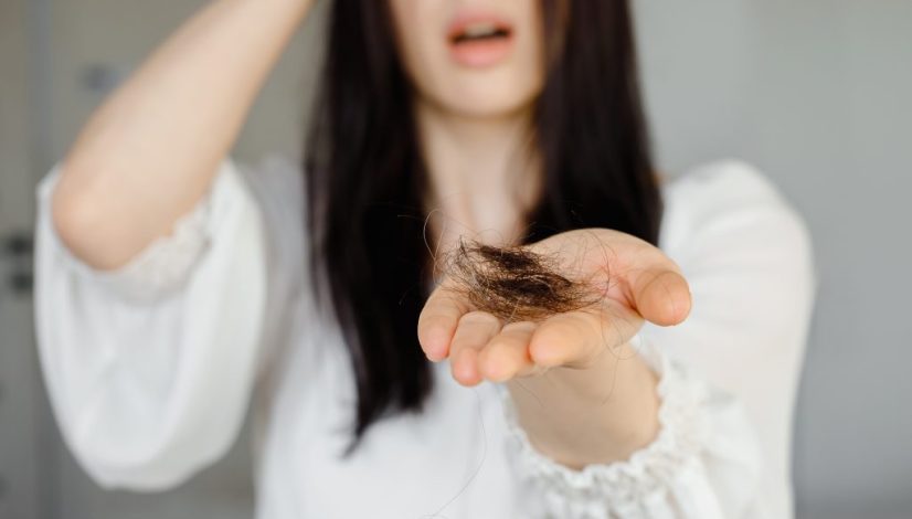 seorang wanita menunjukkan rambut rontok