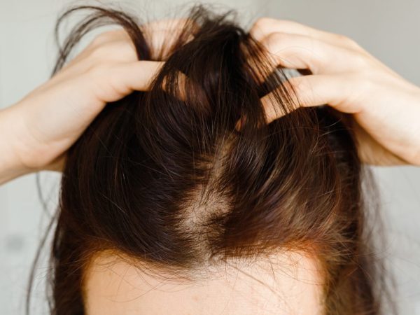 scalp detox perempuan di lavalen beauty