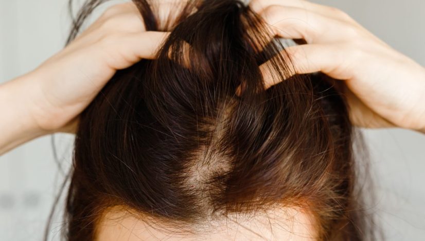 scalp detox perempuan di lavalen beauty