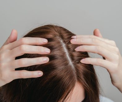 cara menghilangkan ketombe di lavalen beauty