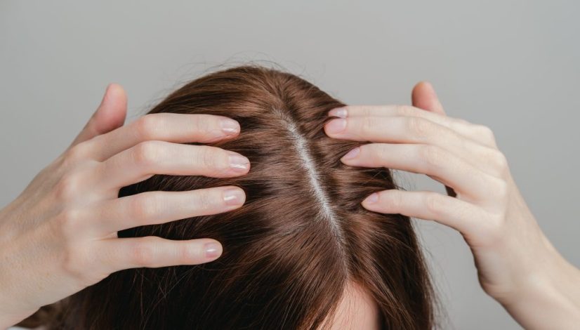 cara menghilangkan ketombe di lavalen beauty