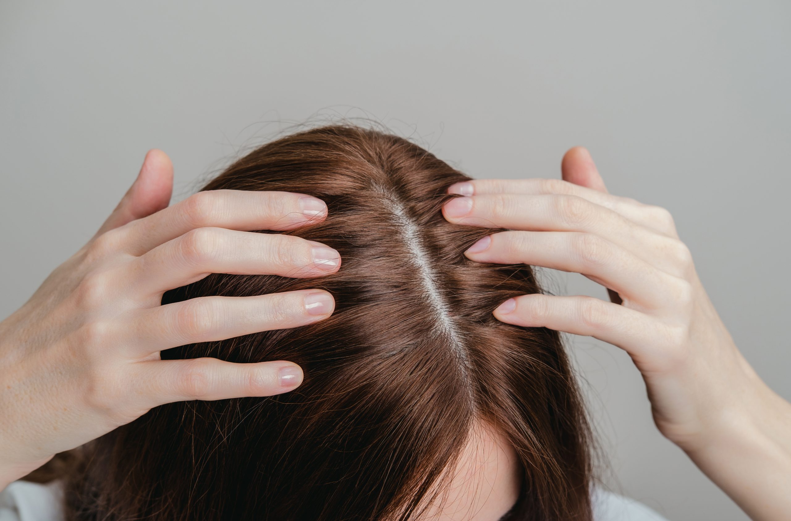 cara menghilangkan ketombe di lavalen beauty