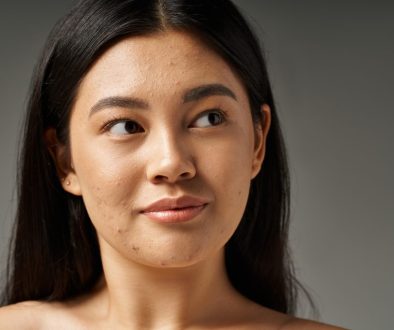 cara mengatasi kulit berminyak di lavalen beauty