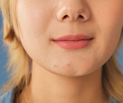 Puffy face karna MSG, begini cara mengatasinya di lavalen beauty