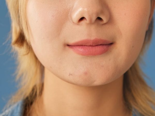 Puffy face karna MSG, begini cara mengatasinya di lavalen beauty