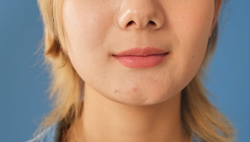 Puffy face karna MSG, begini cara mengatasinya di lavalen beauty