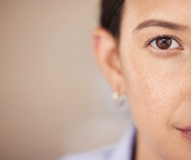cara menghilangkan flek hitam di lavalen beauty