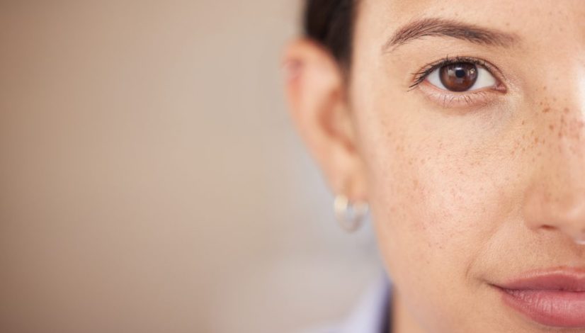 cara menghilangkan flek hitam di lavalen beauty