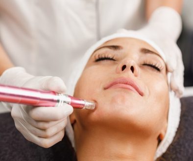 treatment microneedling di lavalen beauty