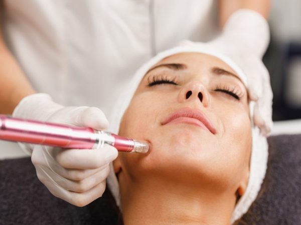 treatment microneedling di lavalen beauty