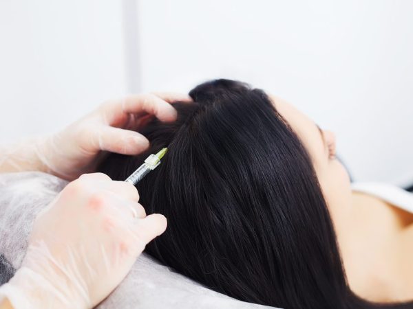 scalp detox