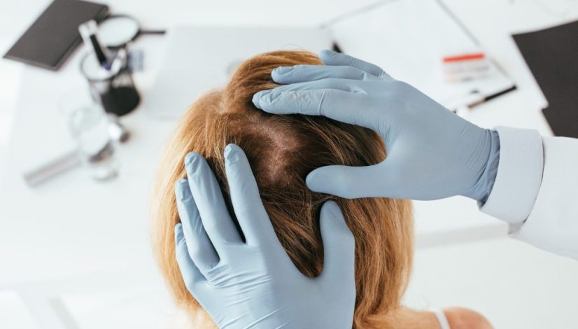 PRP rambut vs Advanced Factor R