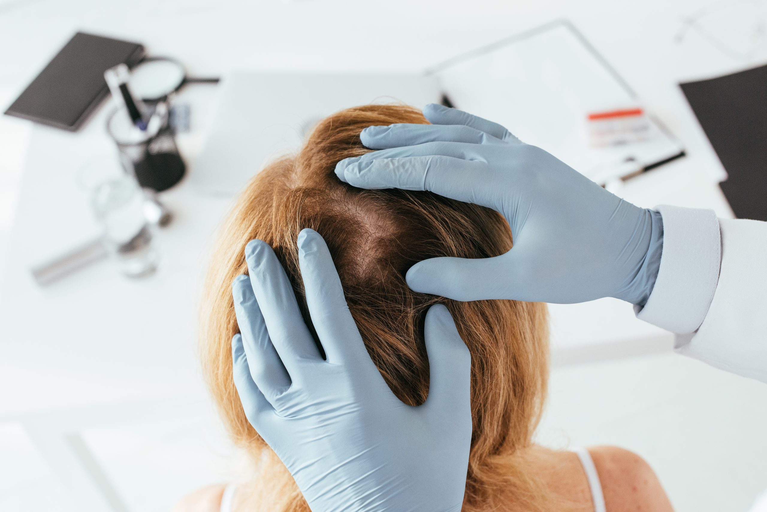 PRP rambut vs Advanced Factor R