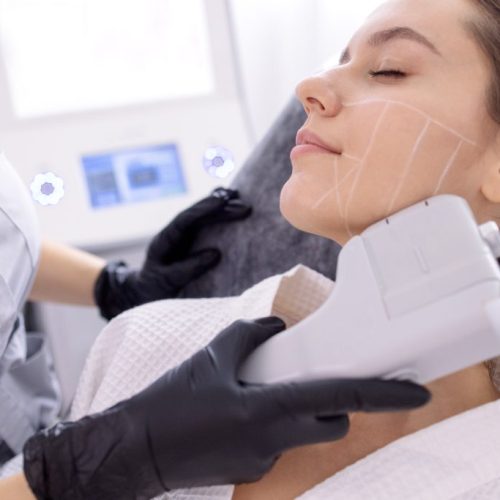 HIFU treatment