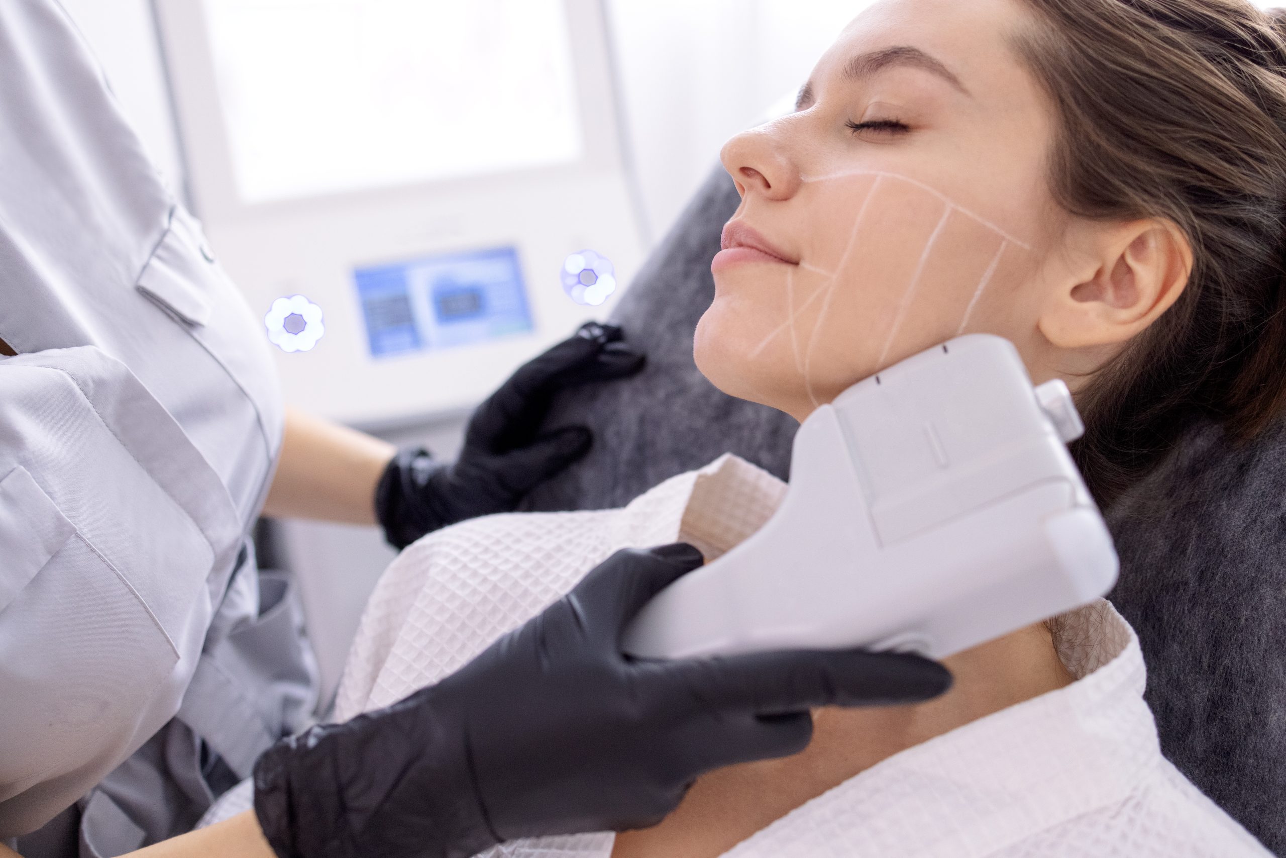 HIFU treatment