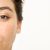 dark spot vs melasma bedanya