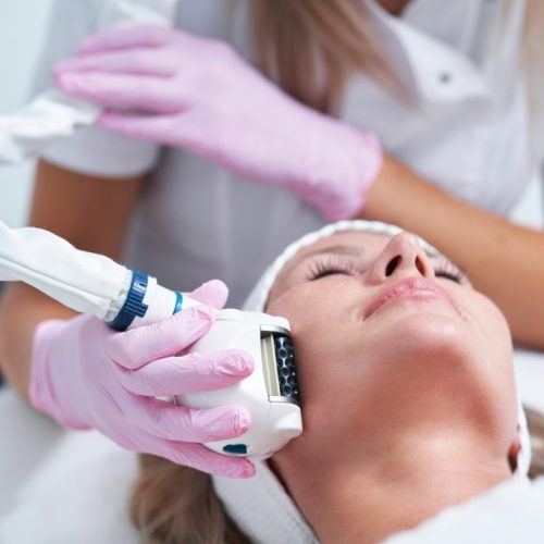 Sofwave treatment