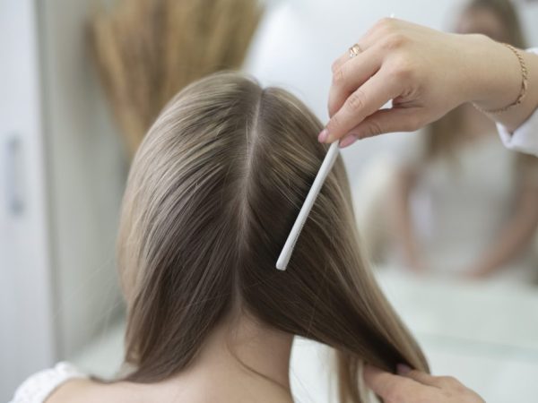 scalp microbiome kesehatan rambut