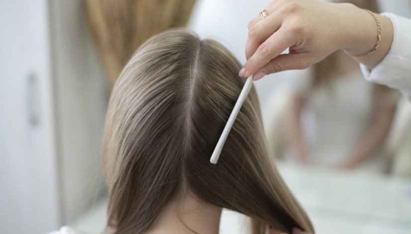 scalp microbiome kesehatan rambut