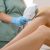 treatment diode laser hair removal