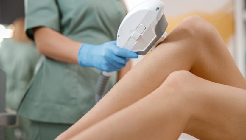 treatment diode laser hair removal