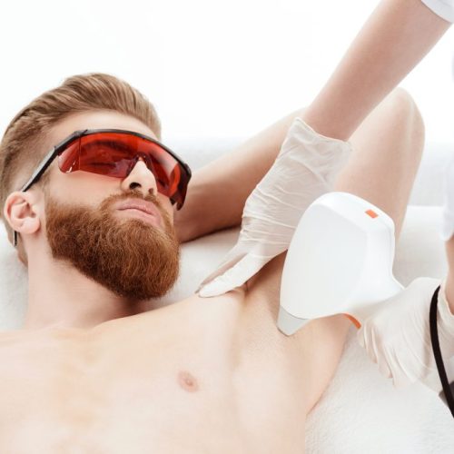 harga laser hair removal pria