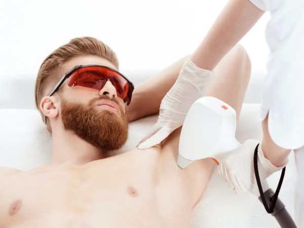 harga laser hair removal pria
